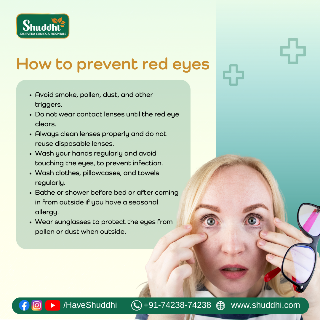 red-eyes-prevention-tips-by-shuddhi-clinics-on-dribbble