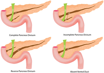 Pancreas flashcard adobe anatomy diagram human illustration illustrator med medicine photoshop publishing research scientific