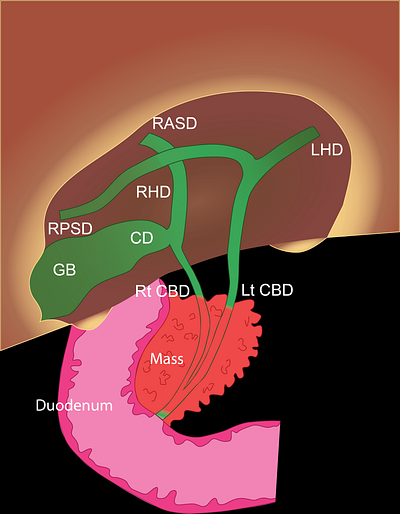 Illustration adobe anatomy design diagram gastro human illustration illustrator med medicine pancreas
