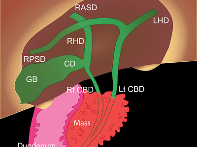 Illustration adobe anatomy design diagram gastro human illustration illustrator med medicine pancreas