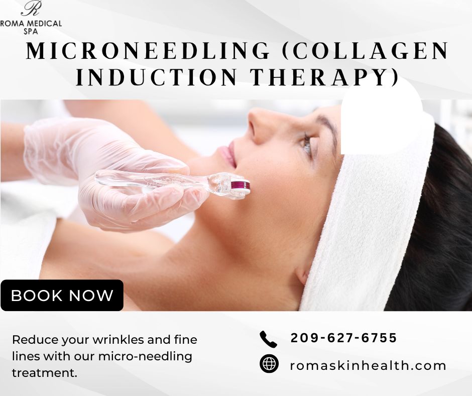 What Is Micro-needling ( Collagen Induction Therapy)? By Roma Skin ...