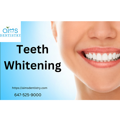 Choose Teeth Whitening in Mississauga dental bonding mississauga teeth whitening mississauga