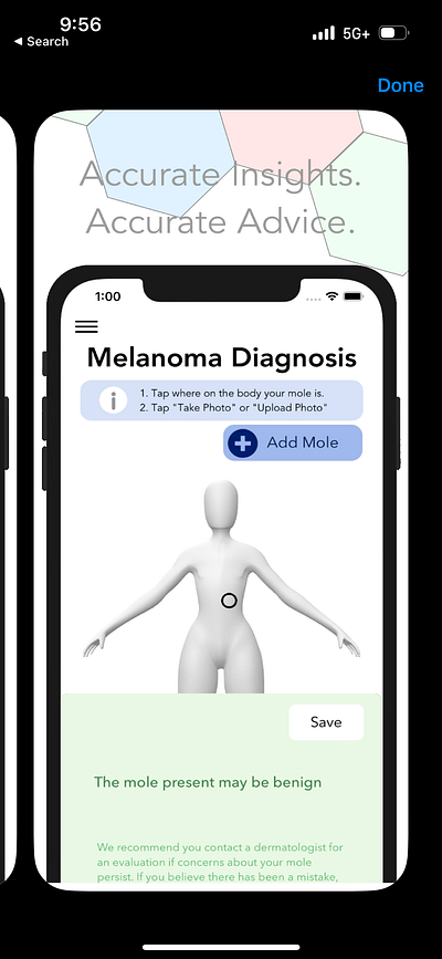 Melatect, a skin cancer detection app apple branding design figma graphic design logo mockup sketch swift swift ui ui