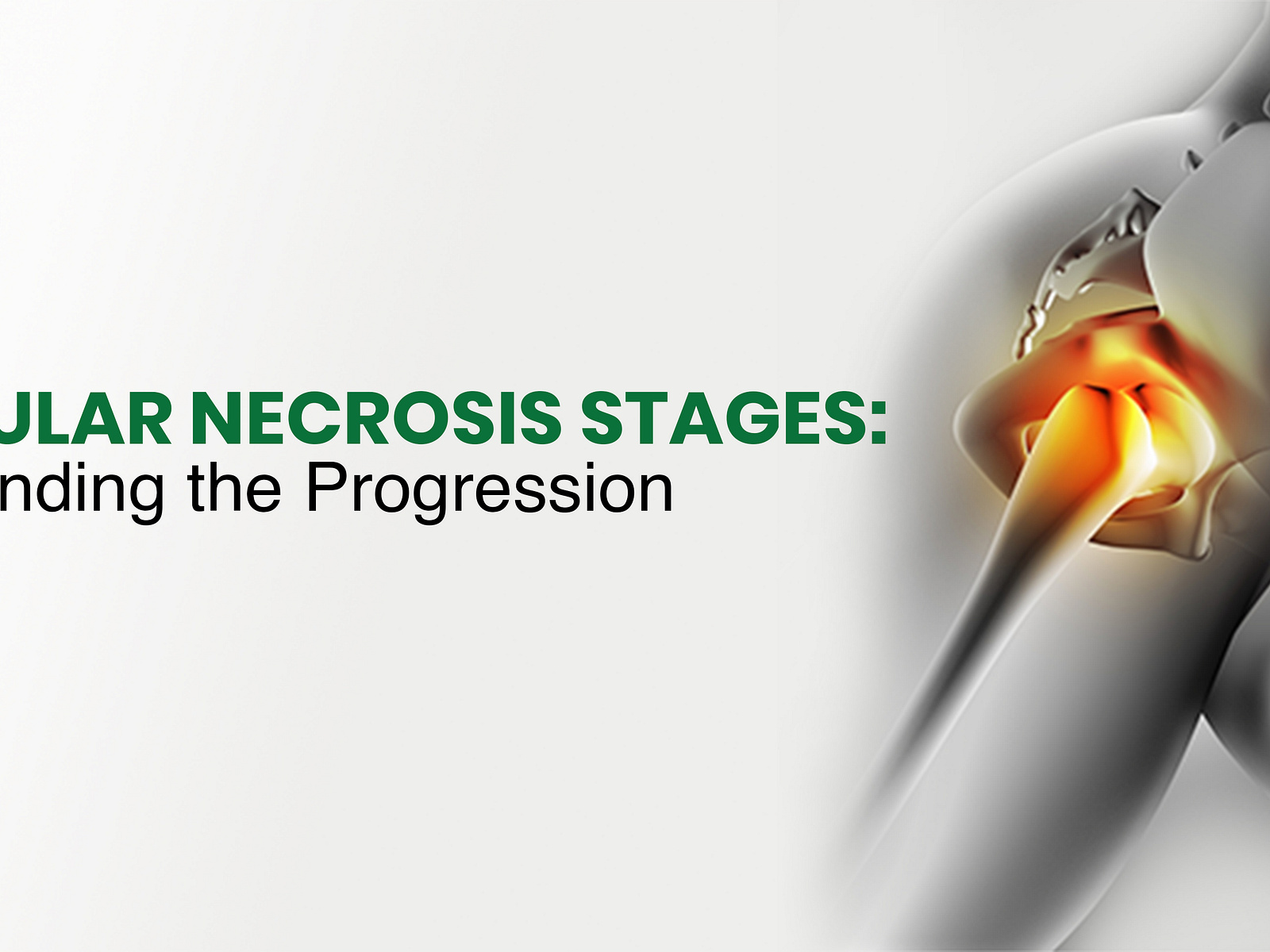 Avascular Necrosis Stages Understanding the Progression by regrow