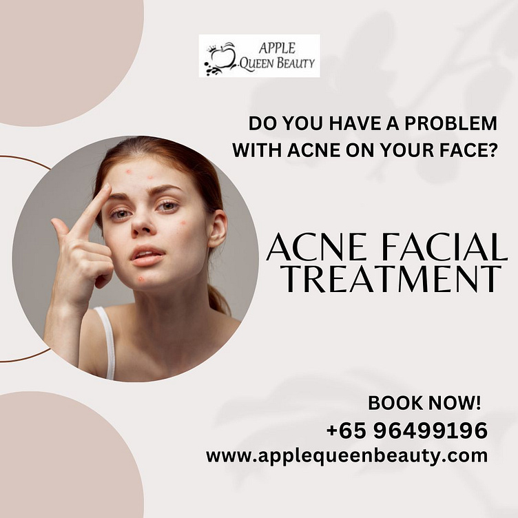 Best Acne Facial Treatment in Singapore by AppleQueen Beauty on Dribbble