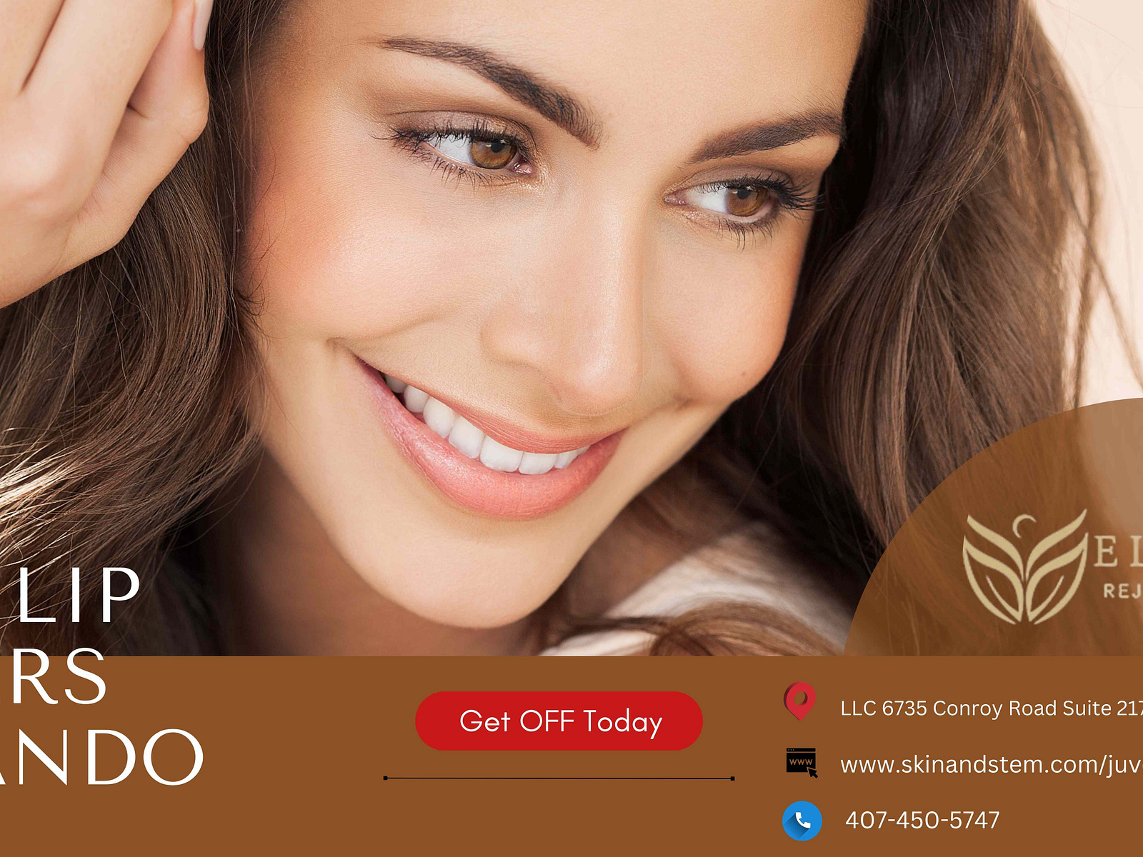 Lip fillers in Orlando are the best way to improve your pout. by