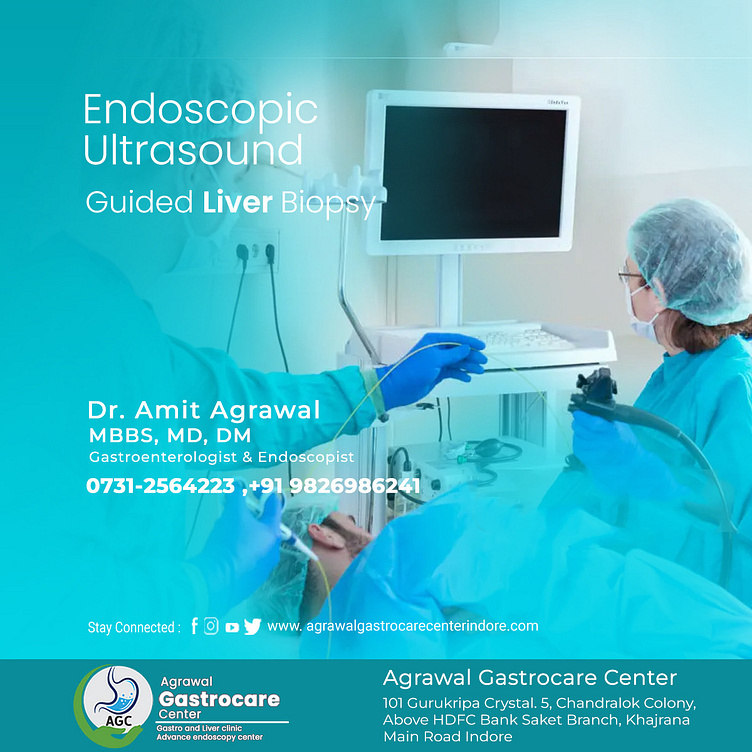 Endoscopic UltrasoundGuided Liver Biopsy by Agrawal Gastrocare Center