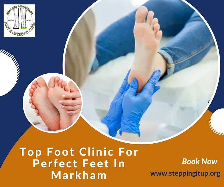 Top Foot Clinic For Perfect Feet In Markham by Steppingitup Clinic on