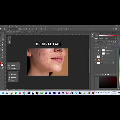 Acne Free Face in Photoshop 3d animation branding creative graphic design illustration logo motion graphics typography