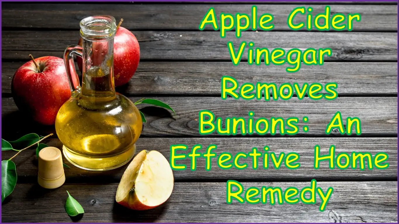 Apple Cider Vinegar Removes Bunions Effective Home Remedy by Kamran on