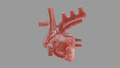 Cardiac Dysfunction blender3d medical animation medical design