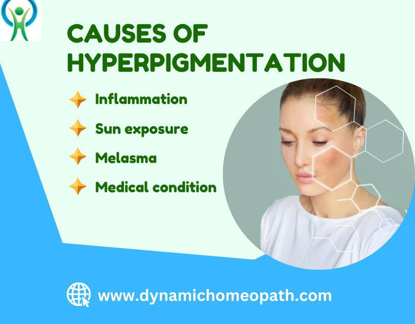 what-can-cause-skin-hyperpigmentation-by-judy-johnson-on-dribbble