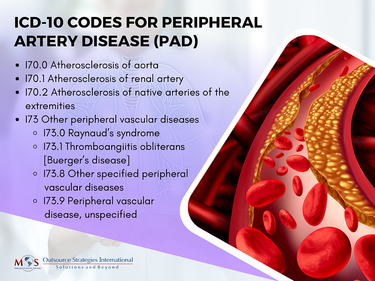 ICD10 Codes to Report Peripheral Artery Disease (PAD) by Outsource
