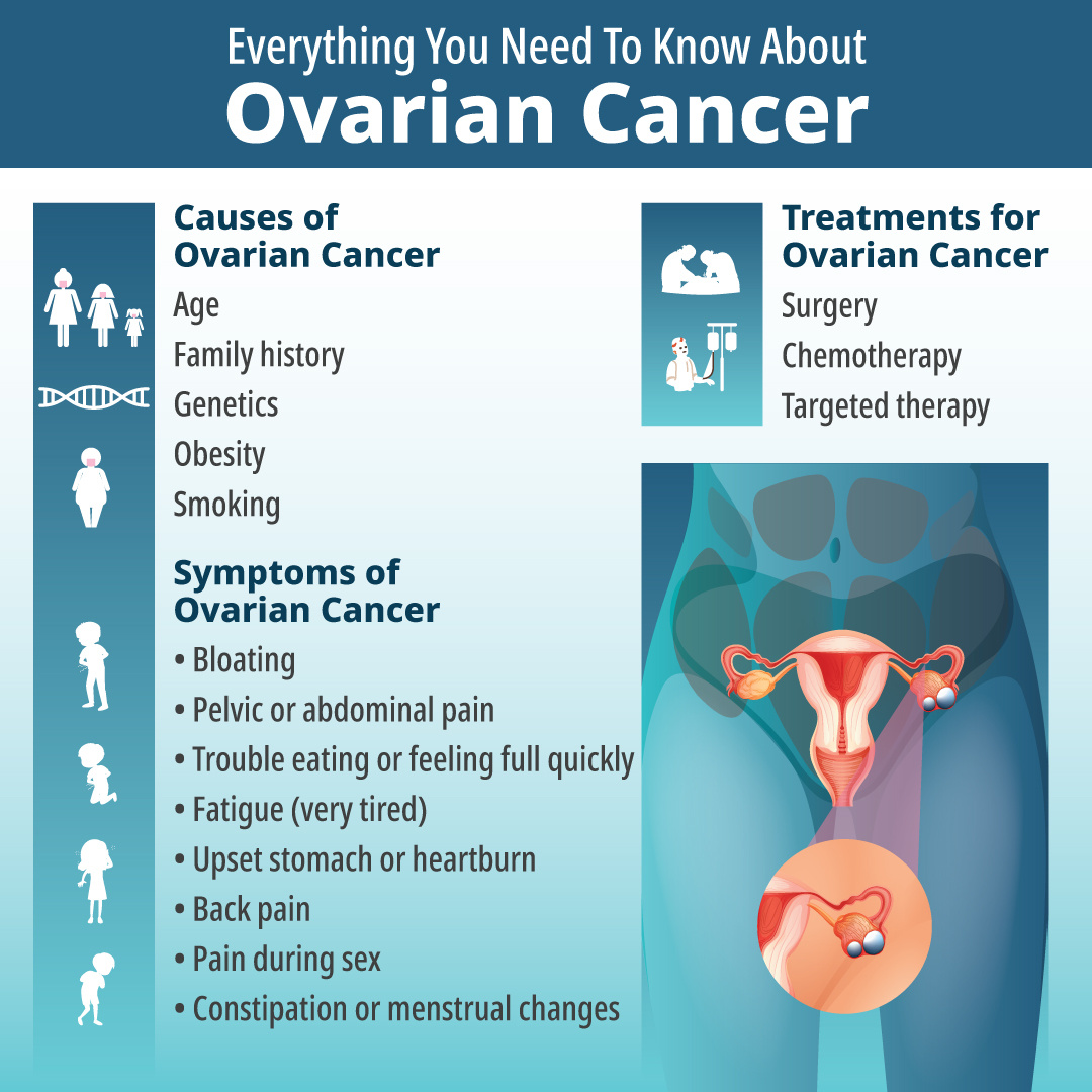 Everything You Need To Know About Ovarian Cancer by Dr. Nilesh Chordiya ...