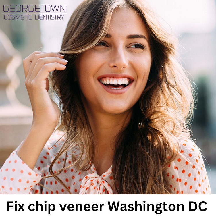 Fix chip veneer Washington DC by Cosmetic Dentistry on Dribbble