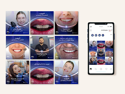 Post cover design for Dr. Khatai's dental clinic beauty branding clinic dental design graphic design illustration instagram photoshop post social media