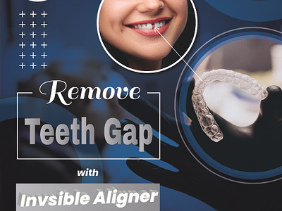 Remove Teeth Gap aligner braces branding brochure business card dental dental post dentist design facebook post flyer graphic design health post illustration logo real estate post teeth tooth ui