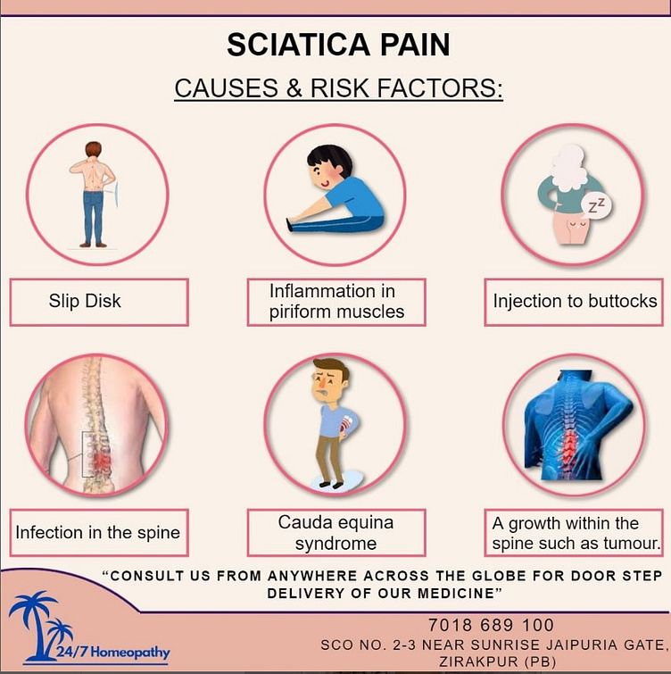 Understanding Sciatica Pain: Causes, Symptoms, and Treatment by 247 ...