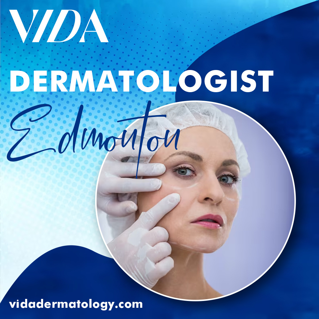 Do You Need The Top Dermatologist In Edmonton? By Vida Dermatology On ...