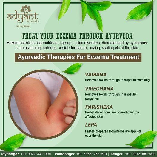 Best Ayurvedic Treatment for Eczema Adyant Ayurveda by Kerala Ayurveda on Dribbble