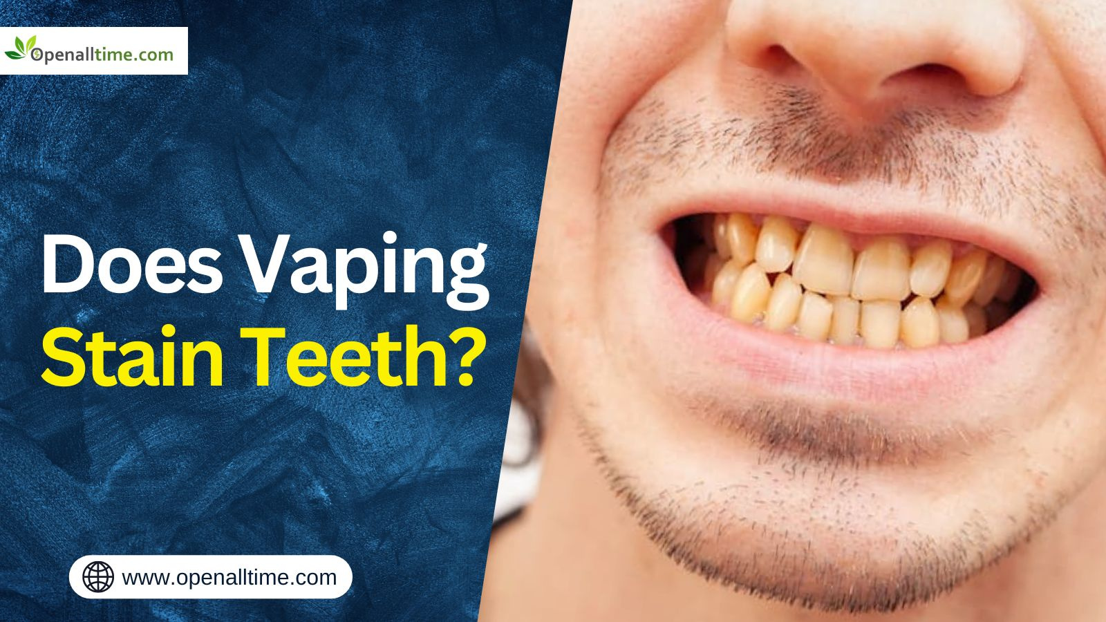 Vaping Teeth Stain? Vaping and Dental Discoloration by cris jordan on