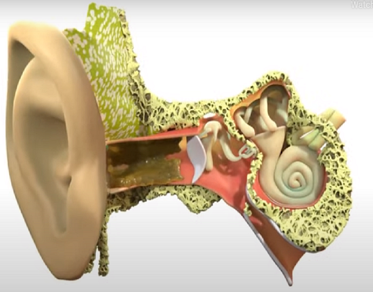 Why Choose Ear Microsuction for Ear Wax Removal by Manchester Hearing
