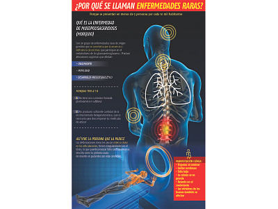 Infografía de las enfermedades cosideradas como "raras" diario pásala graphic design infografía infographics