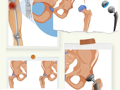 Medical illustration graphic design medical illustration