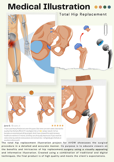 Medical illustration graphic design medical illustration