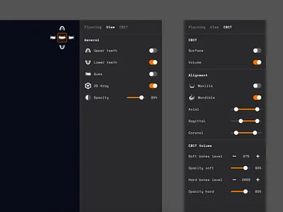 Teeth alignment software