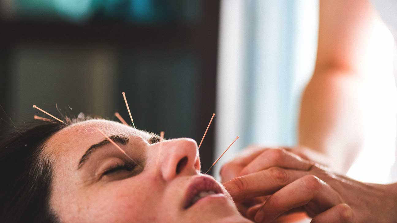 Cosmetic acupuncture Albuquerque by Lisa Warner on Dribbble