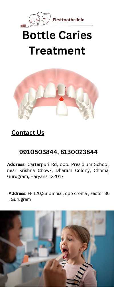 Bottle Caries Treatment in Gurgaon- FirsttoothClinic bottlecariestreatment dental care for children