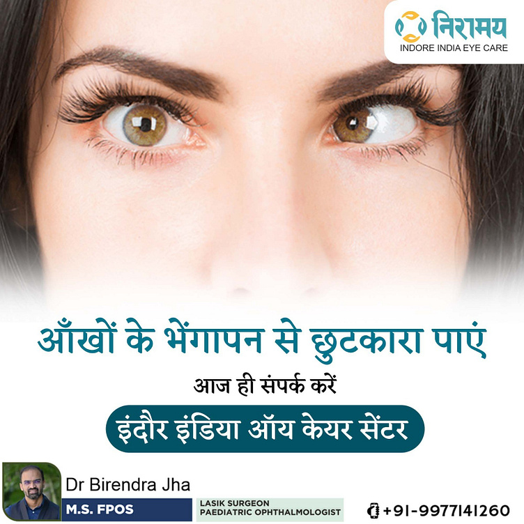 Squint Treatment in Indore Indore India Eye Care by Ophthalmologist