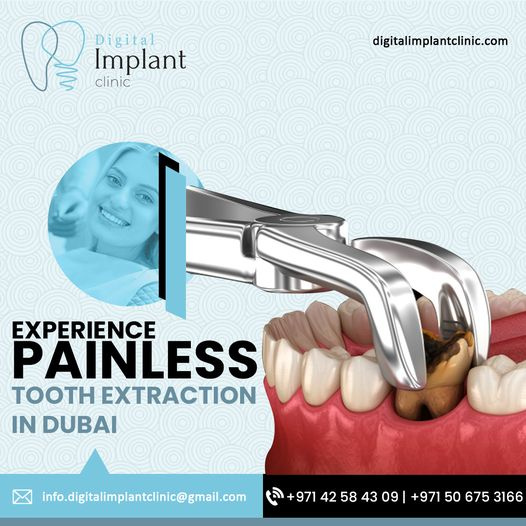 Tooth Extraction in Dubai Professional & Painless ToothRemoval by