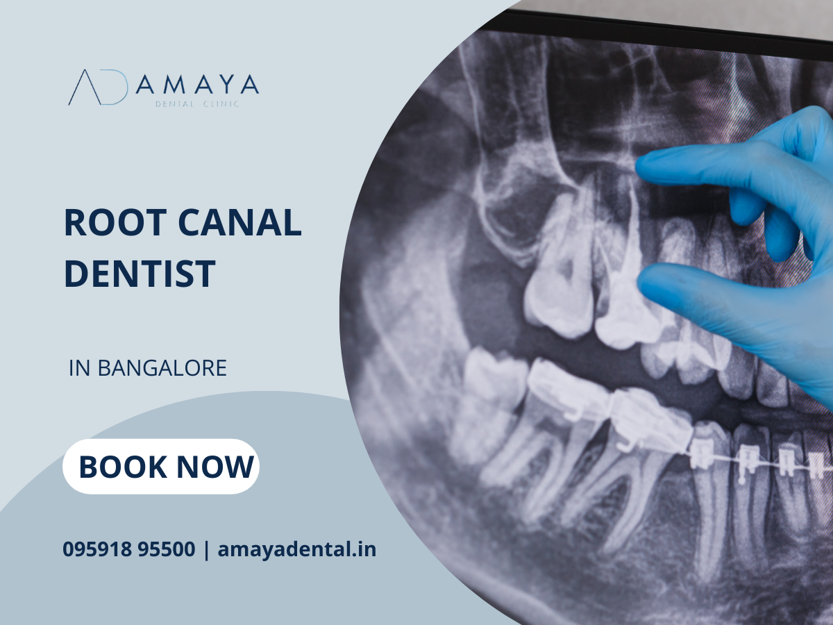 Get Skilled Root Canal Dentists in Bangalore by Amaya Dental Clinic on