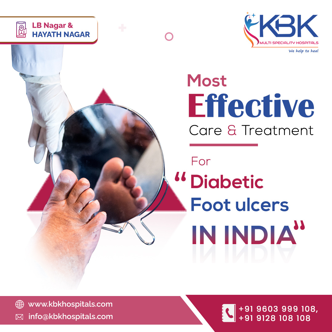 Diabetic foot ulcer treatment in India KBK Hospitals by KBKHospitals
