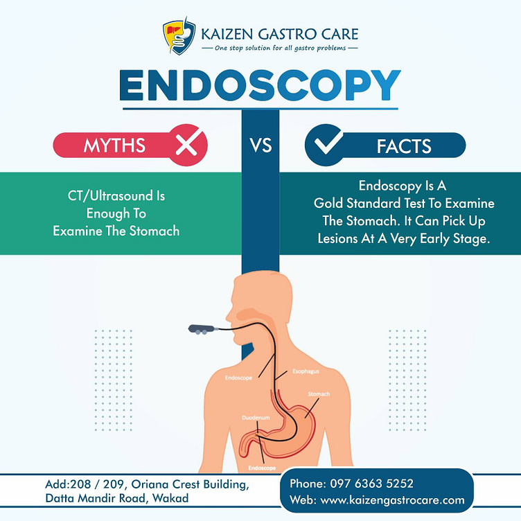 Endoscopy Myths VS Facts Kaizen Gastro Care by Kaizen Gastro Care on Dribbble
