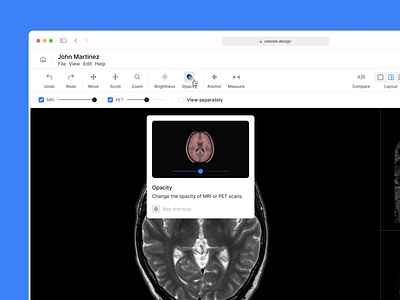 Medical Web App ananlysis anotation black brain branding dashboard design device help illustration images medical mri pet tooltip ui ux website websites white