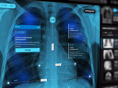 User Interface for X-ray Specialists animation dailyui dashboard dashboard design data viz dataviz design design of the day dribbble health health ui interface medical minimal modern motion graphics ui ui designer ui inspiratio ui trends