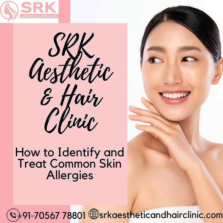Skin Allergy Doctor in Sonipat by srk asthetic on Dribbble