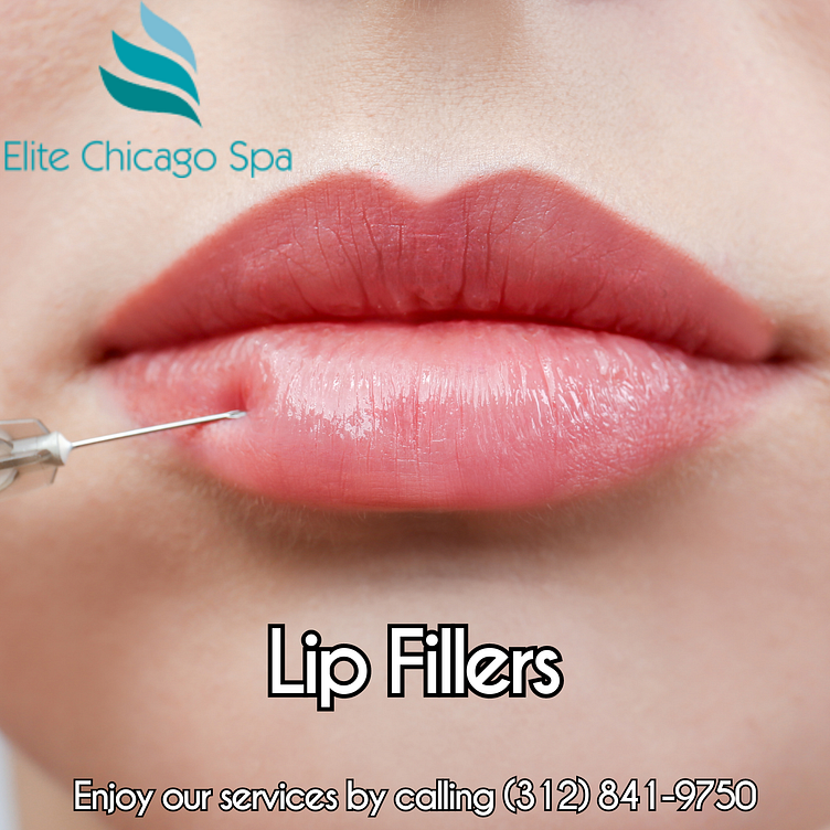 Lip Fillers Chicago Injections by Elite Spa Chicago on Dribbble