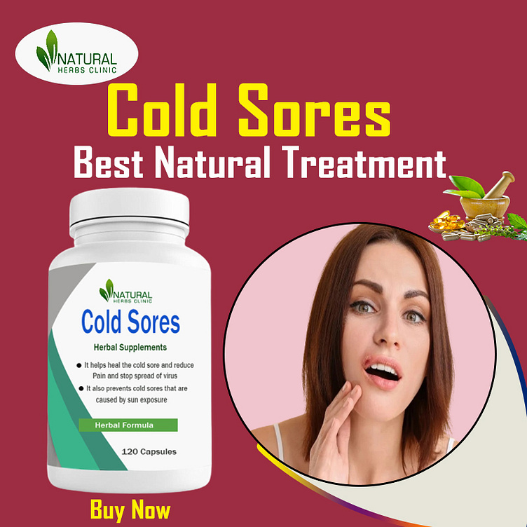 natural-remedies-for-cold-sores-to-reduce-duration-and-time-by-michael