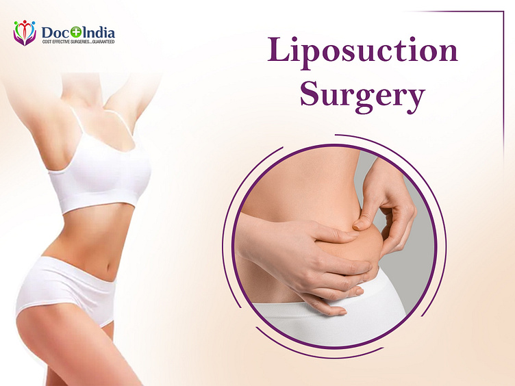 Liposuction Surgery In Hyderabad Doc Plus India by Docplus India on