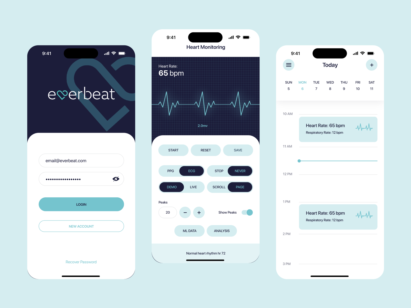 Heart Monitoring App by uixdesign on Dribbble