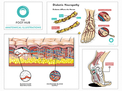 Anotimacal graphic for a Foothub AU co. 2d adobe illustrator anatomical anatomy behance foothub healthy icon design illustration infographic infographic design outlined presentation vector design web graphics
