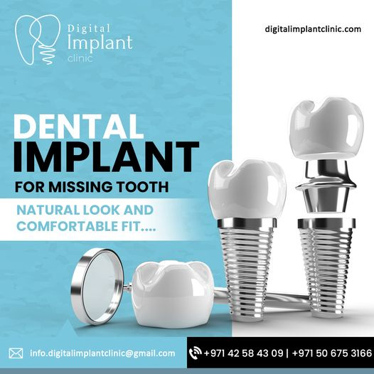 Dental Implants The Gold Standard for Tooth Replacement Dubai by
