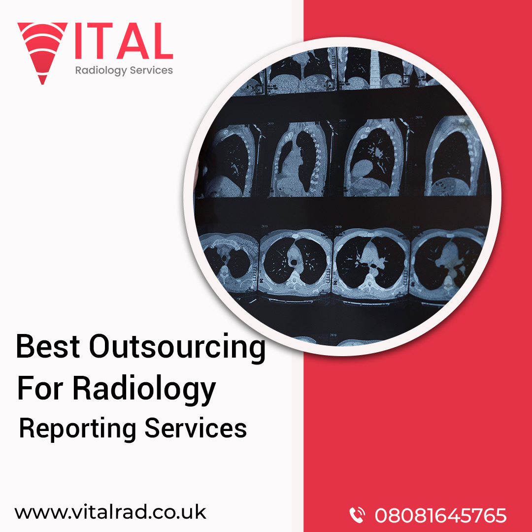 Best Outsourcing for Radiology Reporting Services by Vital Radiology
