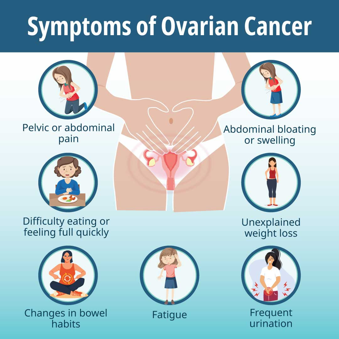 ovarian-cancer-key-symptoms-of-ovarian-cancer-by-dr-nilesh-chordiya