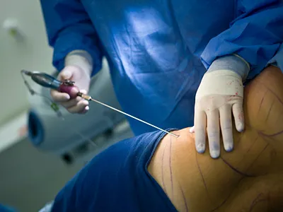 Dry Needling in Athens branding dry needling in athens ui