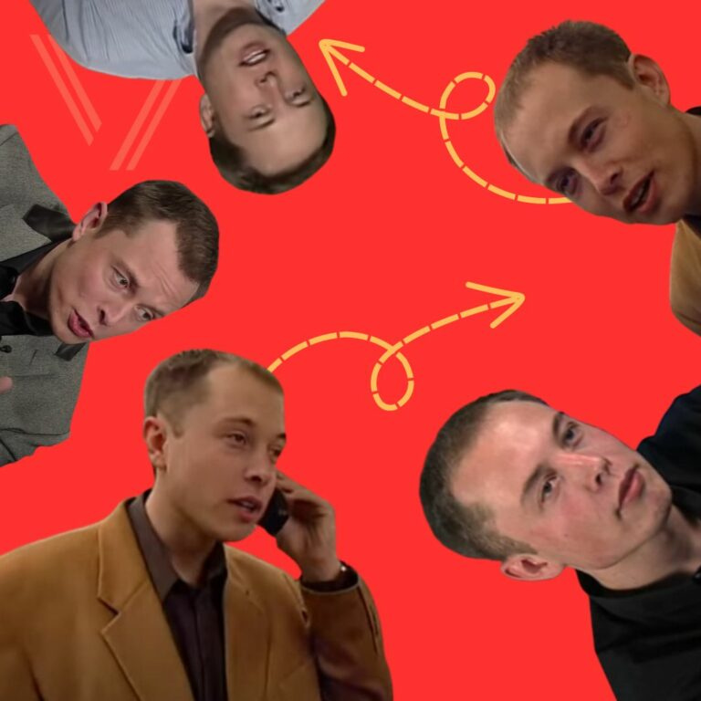 elon musk hair transplant